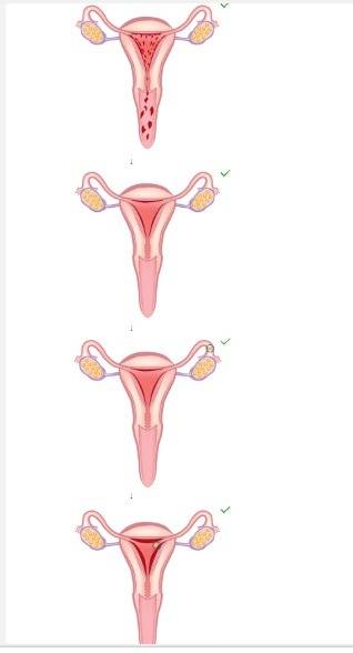 The diagrams represent different phases of the menstrual cycle. arrange these diagrams of the female