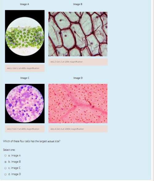 Which of these four cells has the largest actual size? i want to double check if my answer is wron