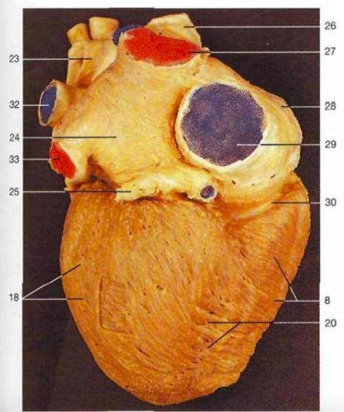 Blood passing through a semilunar valve will enter an artery. a. true b. false