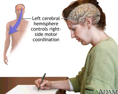 In most people, the left cerebral hemisphere controls a. the left side of the body. b. the right sid