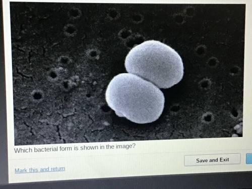 Consider this microscopic image of bacteria. spherical bacteria is shown. which type of bacteria is