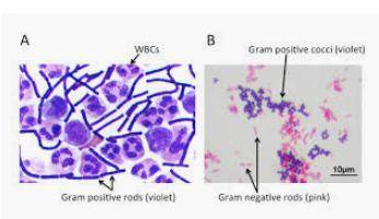 What is the structural feature of gram-positive bacteria that results in their retaining a crystal v