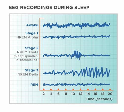 How have researchers determined that there are four NREM stages of sleep and one REM stage of sleep?