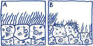 Explain why a disease that affects cells is a problem for the whole organism.