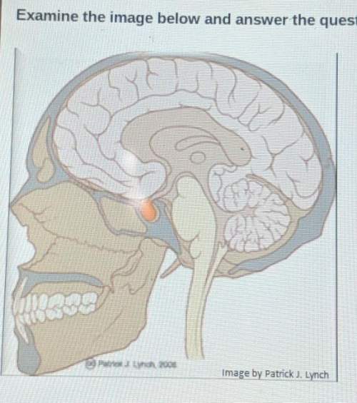 The orange dot in the above image represents the location of which endocrine gland? a. adrenal