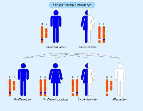 One type of muscular dystrophy, Duchenne muscular dystrophy, is is an inherited condition that usual