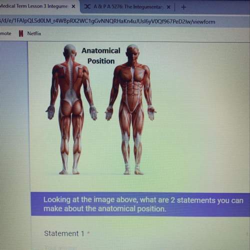 Looking at the image above what are 2 statements you can make about the anatomical position. &lt;