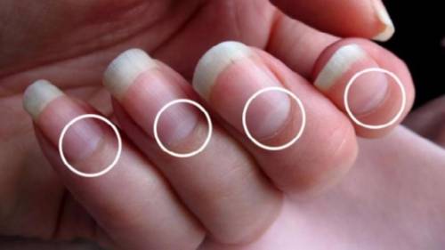 8. The little moon” of your nail is the:a. Cuticleb. Lunulac. Nail bodyd. Nail bed