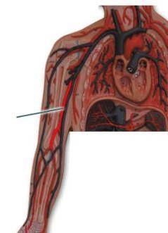 What are the terminal branches of the highlighted artery? What are the terminal branches of the high