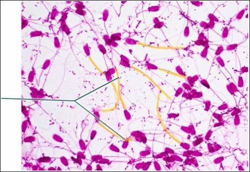 Which structure is highlighted? Which structure is highlighted? collagen fibers elastic fibers tails