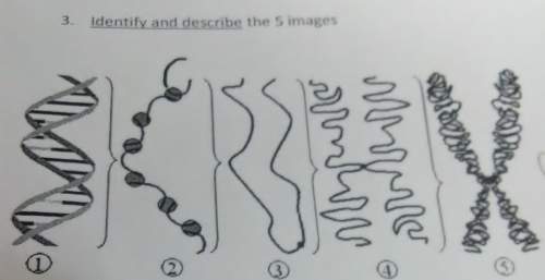 Ineed i need to identify these images (i'm doing a chromosome worksheet) can someone me identifyi