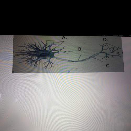 Ineed with this ! it’s a pic of neuron and i want you to type the name for corresponding anatomica