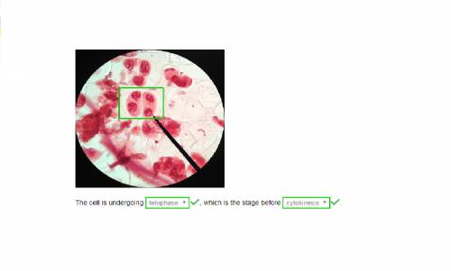 Which phase or mitotic division is the highlighted cell undergoing