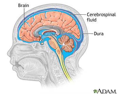 Which of the following would happen if a brain injury damaged the cells that secrete cerebrospinal f