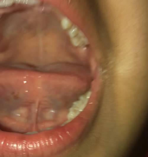 Brown thing under my tongue? What could this be?