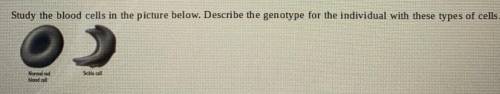 Study the blood cells in the picture below. Describe the genotype for the individual with these type