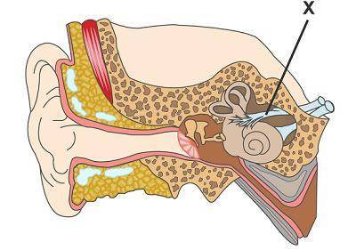 This is a diagram of the ear. Which structure is marked with an X? optic nerve auditory nerve cochle