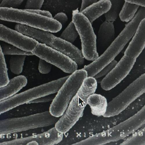 Consider this microscopic image of bacteria, based on its shape, what is it most likely the form of