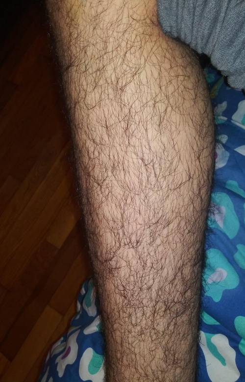 I am a 15 year old boy should I do anything to my leg hair? plz answer then u can delete