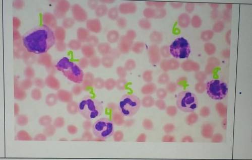 I really need help. to identify which one(s) are neutrophil, eosinophil, basophil and lymphocyte