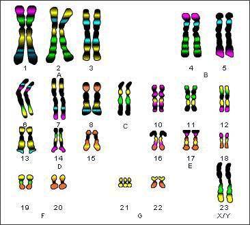 Describe an individual with the karyotype shown. A. a male with Down syndrome B. a female with Down