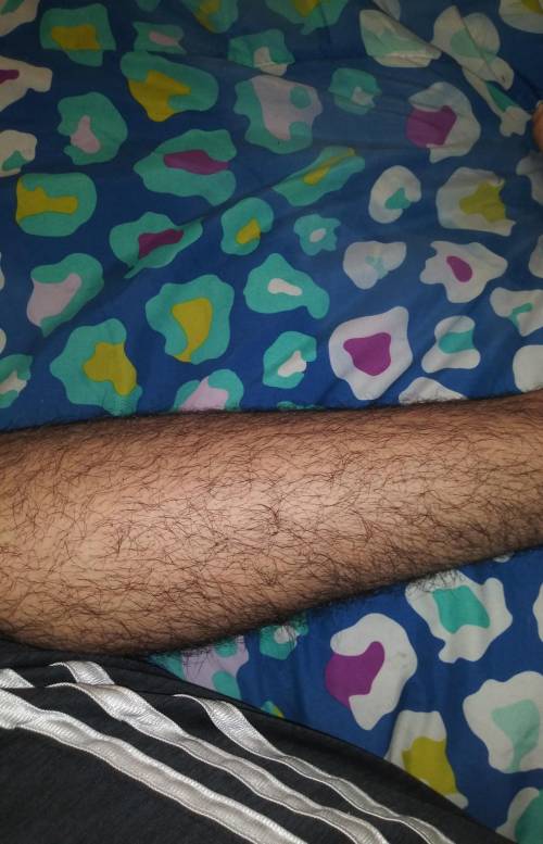 I am a 15 year old boy, should I shave my legs? and my armpits are the same as my legs should I shav