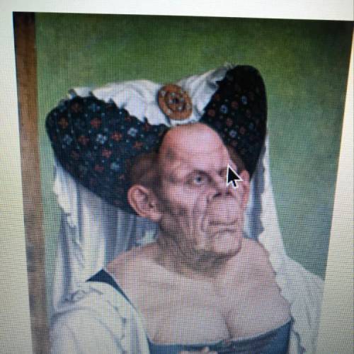 Look at Quentin Massys's Grotesque Old Woman. This portrait most likely has: