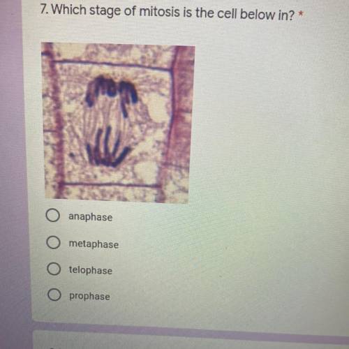 Which stage of mitosis is the cell below in ?
