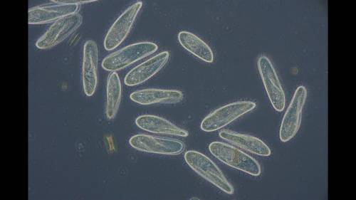 The picture show multiple organisms called paramecia. Although paramecia (single-celled organisms)