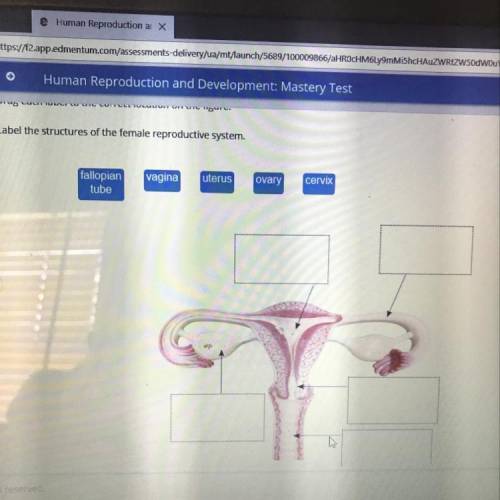 Label the structures of the female reproductive system