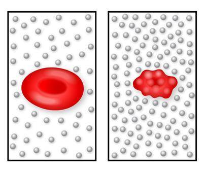 The diagram shows a normal red blood cell and a shrunken red blood cell, both of which are in salt