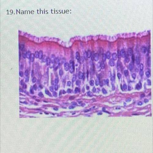 Name this tissue. i’ll make someone brainiest please helppp