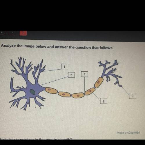 Which line points to the myelin sheath?