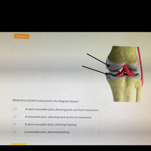 What kind of joint is pictured in the diagram shown? Need Answer ASAP