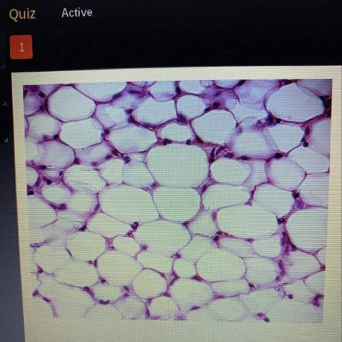 Which level of organization is pictured?

O cell
O tissue
O organ
O organ system
Please help