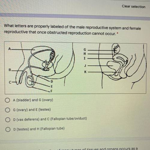 What letters are properly labeled of the male reproductive system and female

reproductive that on