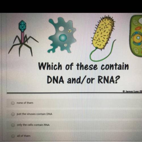 PLEASE HELP 
Which of these contain
DNA and/or RNA?