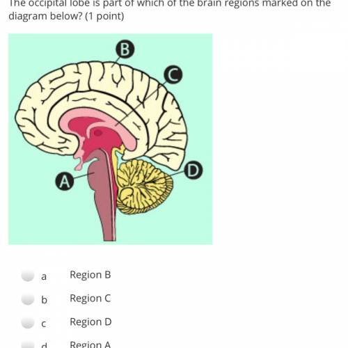 The occipital lobe is part of which of the brain regions marked on the diagram below? (1 point)

A