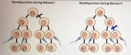 Nondisjunction is the failure of chromosones to seperate correctly during cell division. Nondisjucn