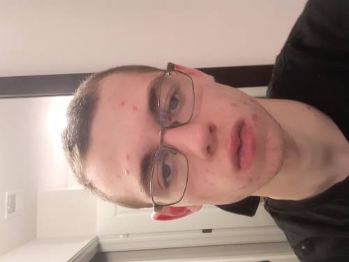 Rate me please 3 pics

No I am not growing out my hair it looks worse so NOMy acne will clear up t