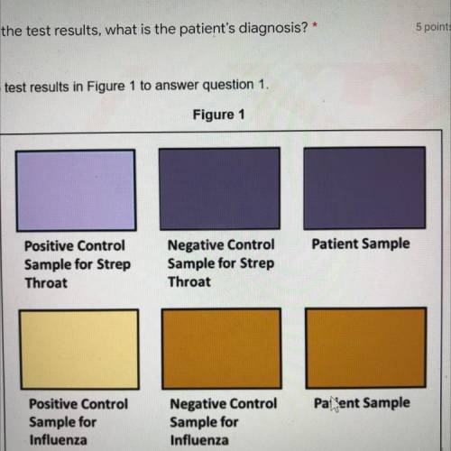 Use the lab test results in Figure 1 answer question 1.

A) the patient does not have a strep thro