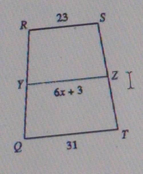 Solve for x. Each figure is a trapezoid