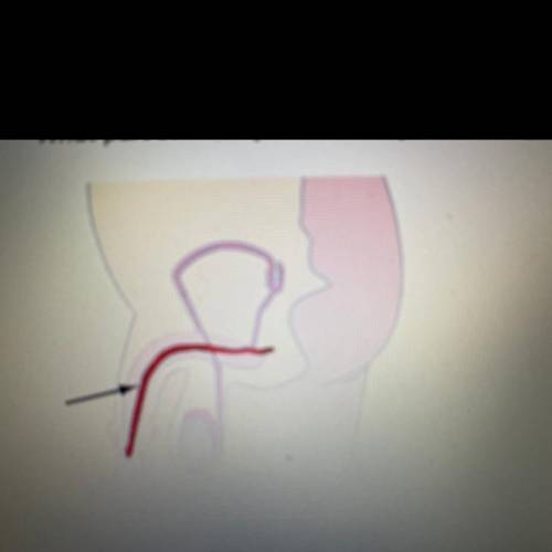 What part of the reproductive system is highlighted below?

OA. Urethra
OB. Epididymus
OC. Seminal