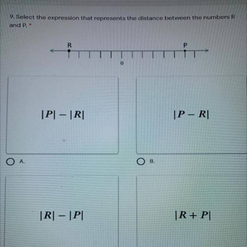 Select the expression that represents the distance between the numbers r and p