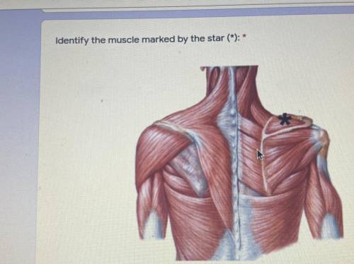 Identify the muscle marked by the star (*): *