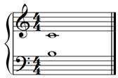 What is the interval of the notes in the picture attached below.