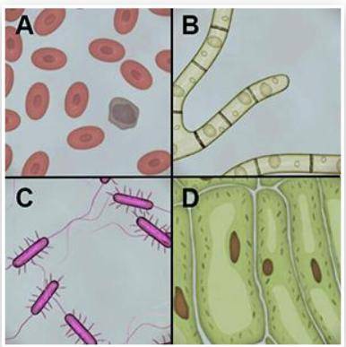 Which of the samples shown below are eukaryotic?

1) B and D
2) B and C
3) A, C, and D
4) A, B, an