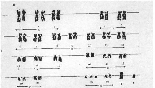 1.) How many pairs of autosomes does this karyotype have? __________

2.) How many pairs of sex ch