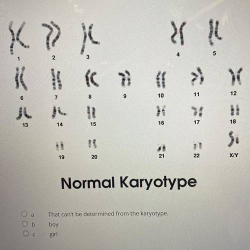 The chromosomes below belong to a human being and is called a karyotype. Is this a karyotype of a b