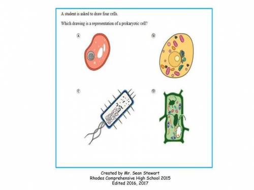 Which drawing is a representation of aprokaryotic cell